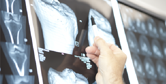 Radiologie 3D femur